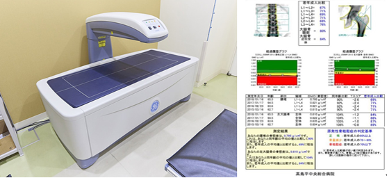 DEXA