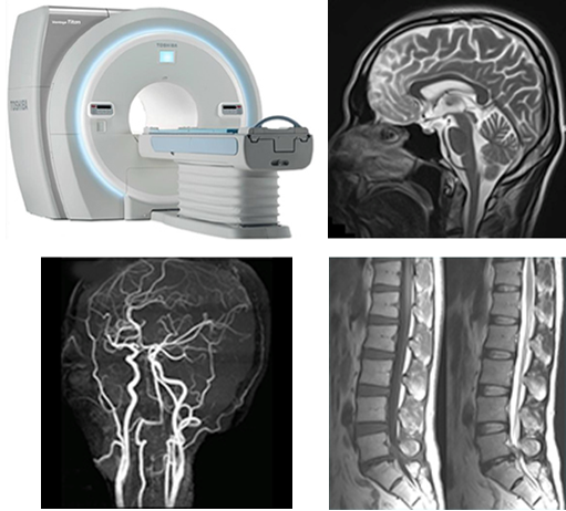 MRI